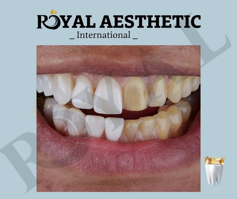 Royal Aesthetic International - Royal Aesthetic International