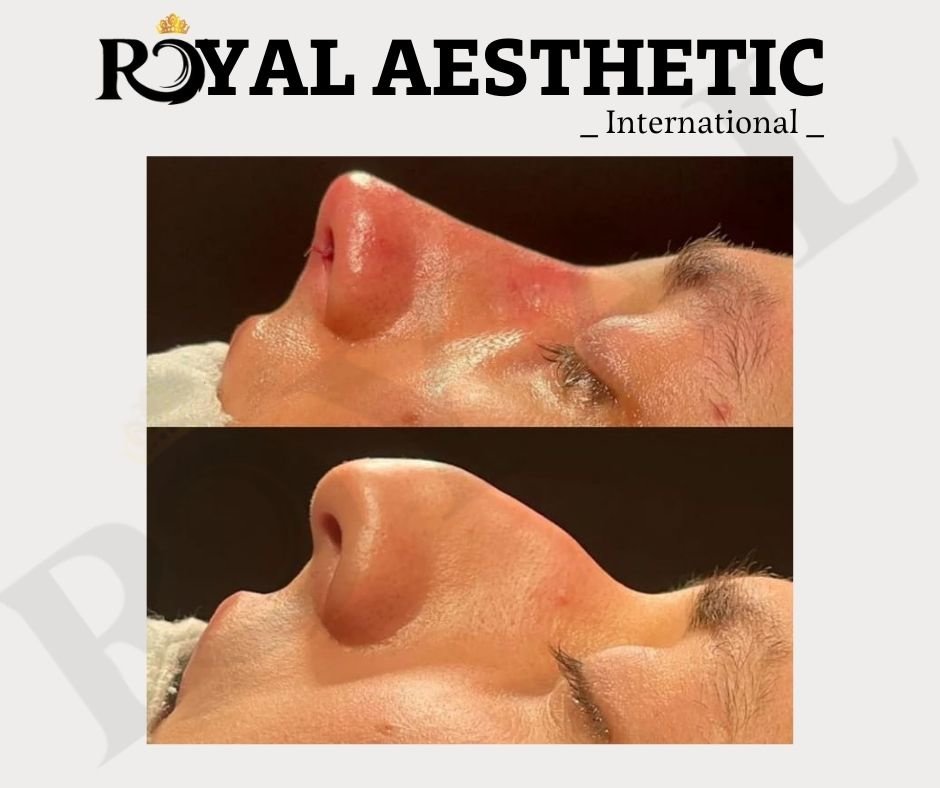Royal Aesthetic International - Royal Aesthetic International