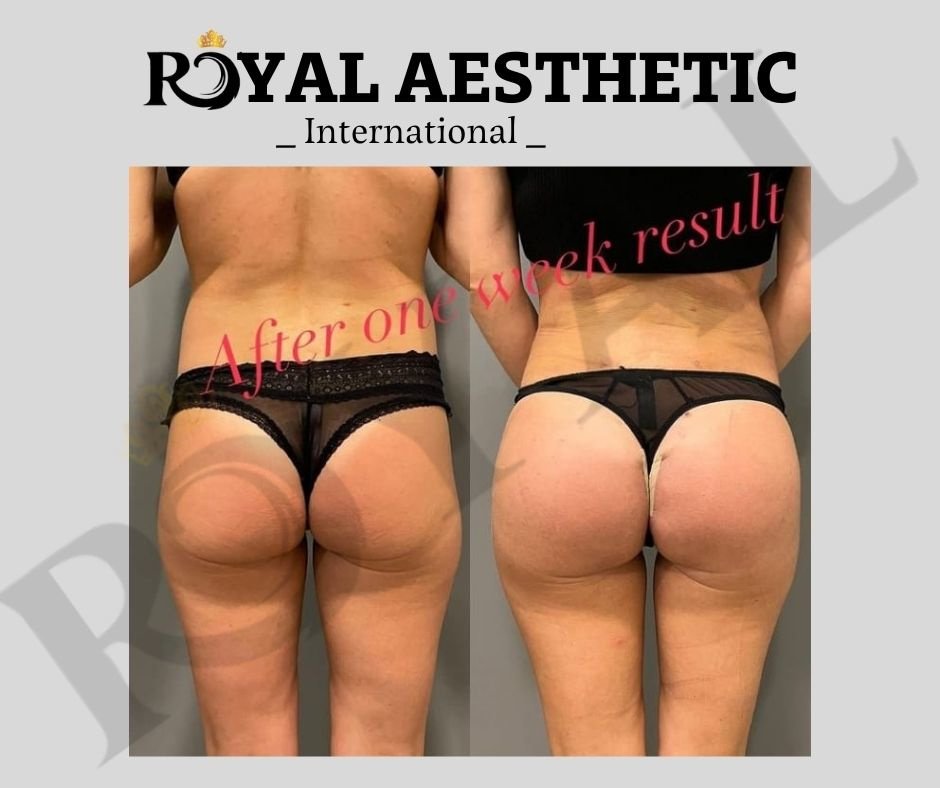 Royal Aesthetic International - Royal Aesthetic International