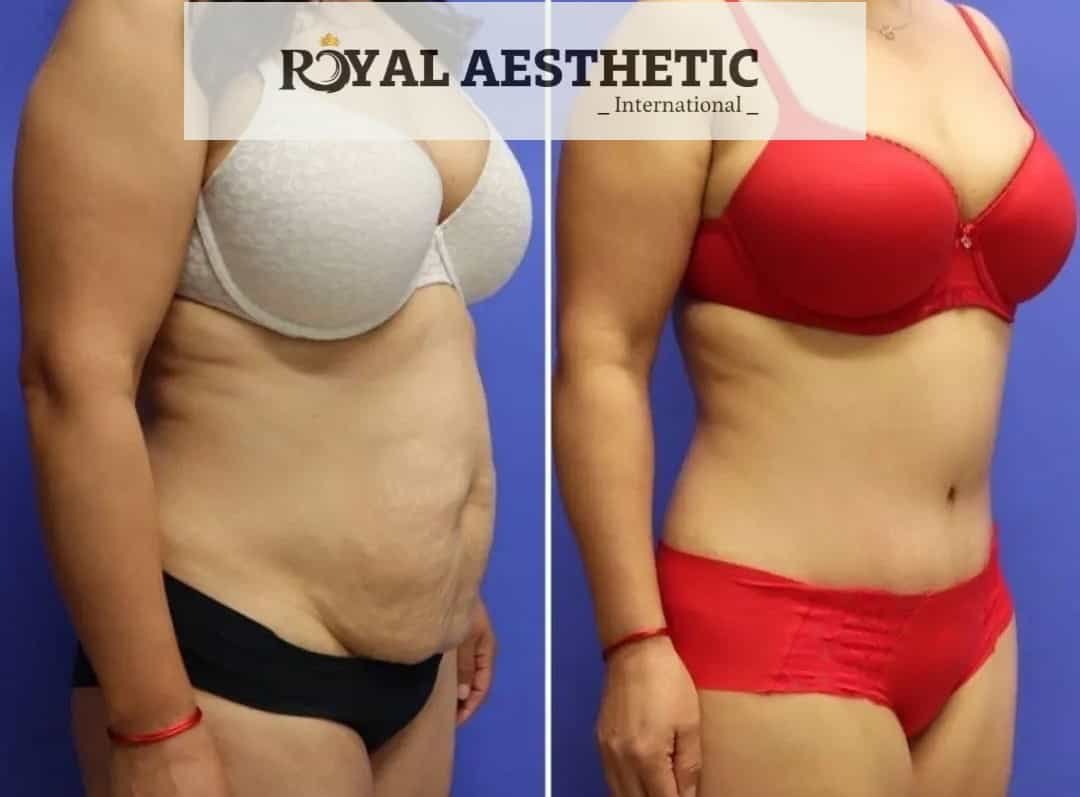 Royal Aesthetic International - Royal Aesthetic International