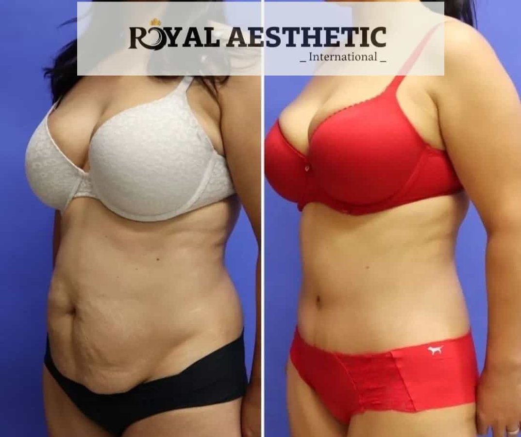 Royal Aesthetic International - Royal Aesthetic International