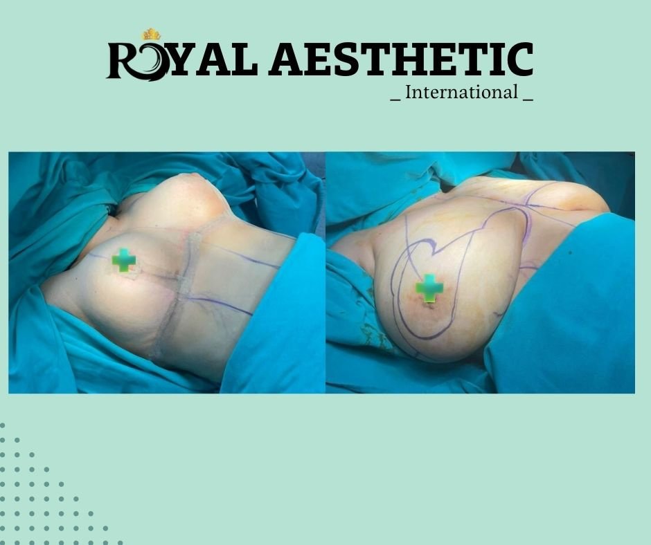 Royal Aesthetic International - Royal Aesthetic International