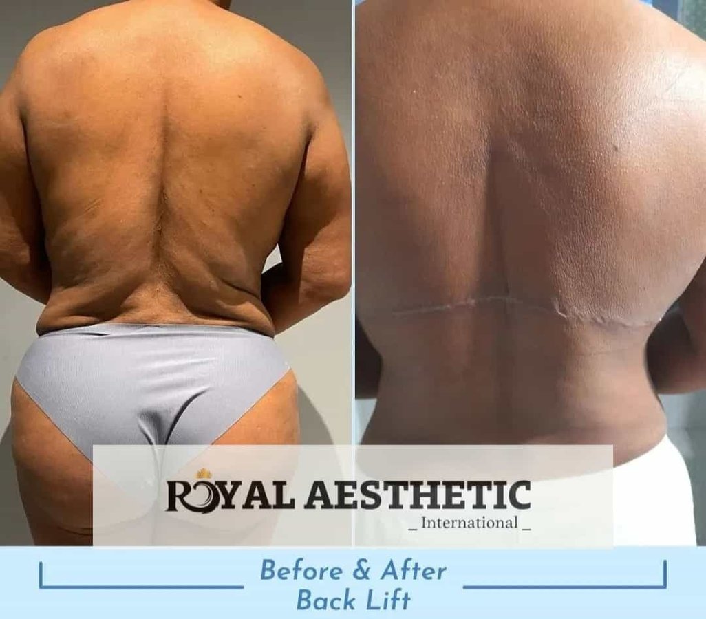 Royal Aesthetic International - Royal Aesthetic International