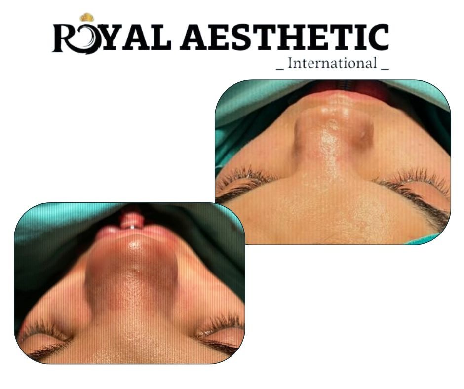 Royal Aesthetic International - Royal Aesthetic International