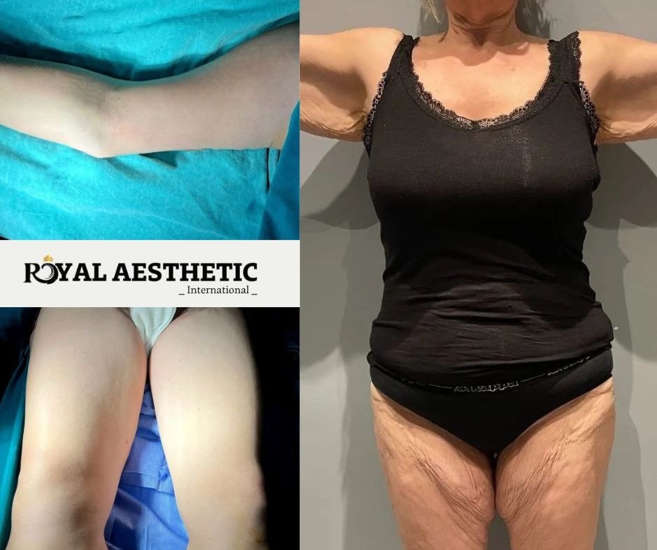 Royal Aesthetic International - Royal Aesthetic International