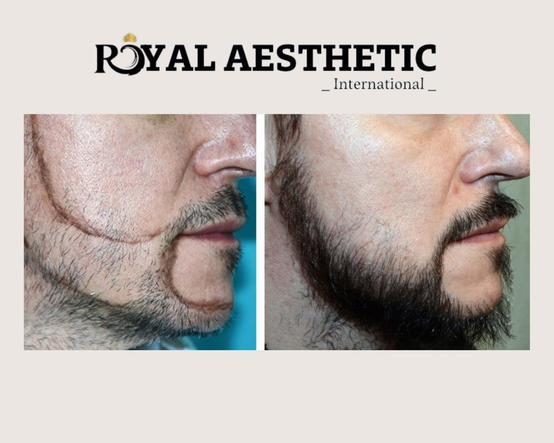 Royal Aesthetic International - Royal Aesthetic International