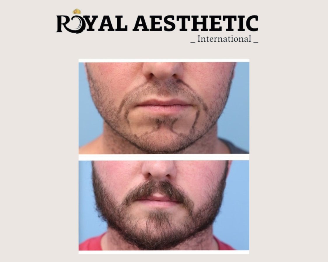 Royal Aesthetic International - Royal Aesthetic International