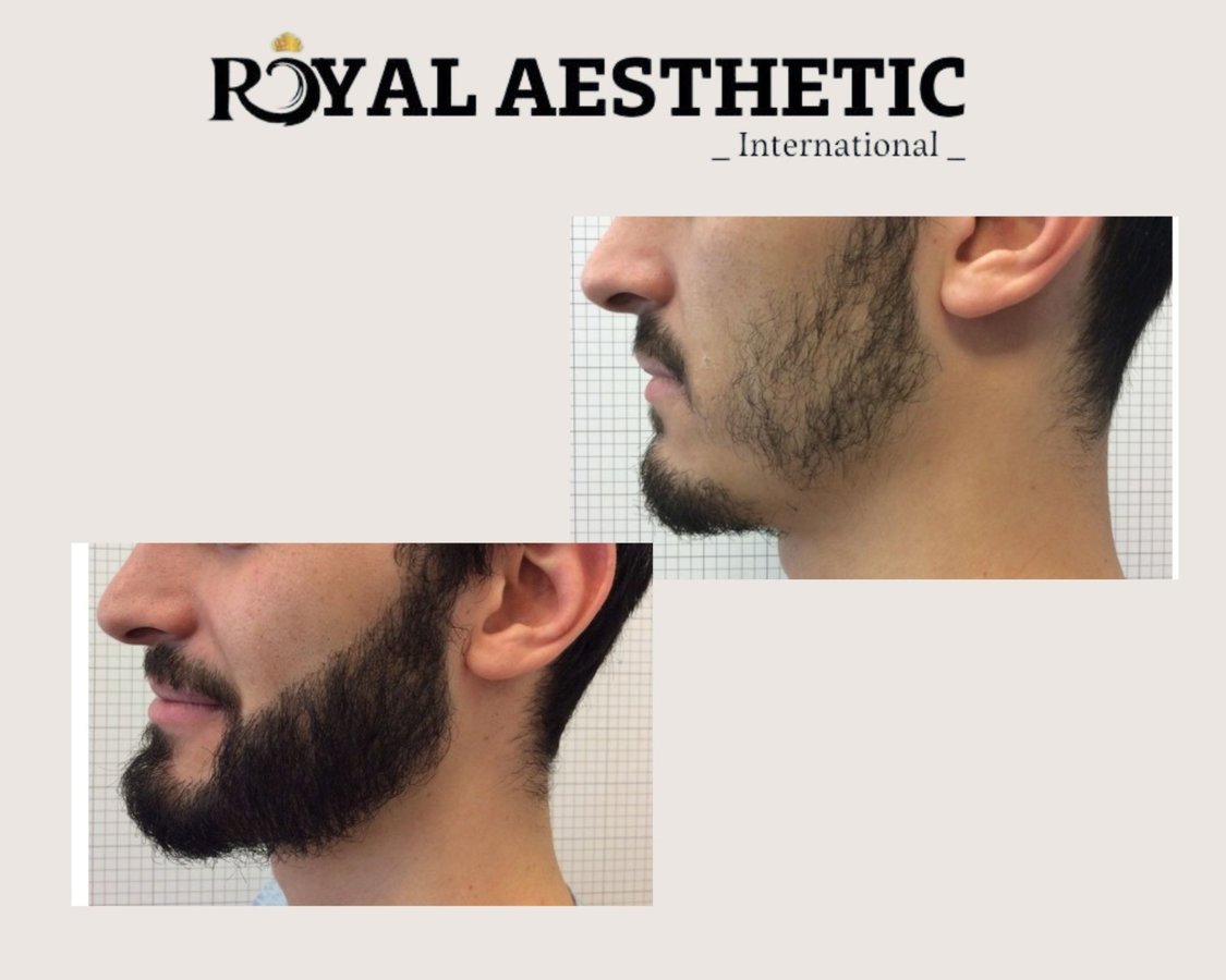 Royal Aesthetic International - Royal Aesthetic International