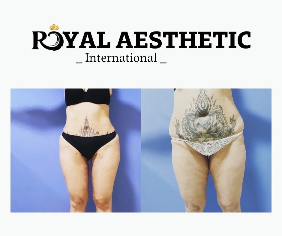 Royal Aesthetic International - Royal Aesthetic International