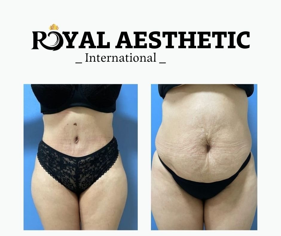 Royal Aesthetic International - Royal Aesthetic International