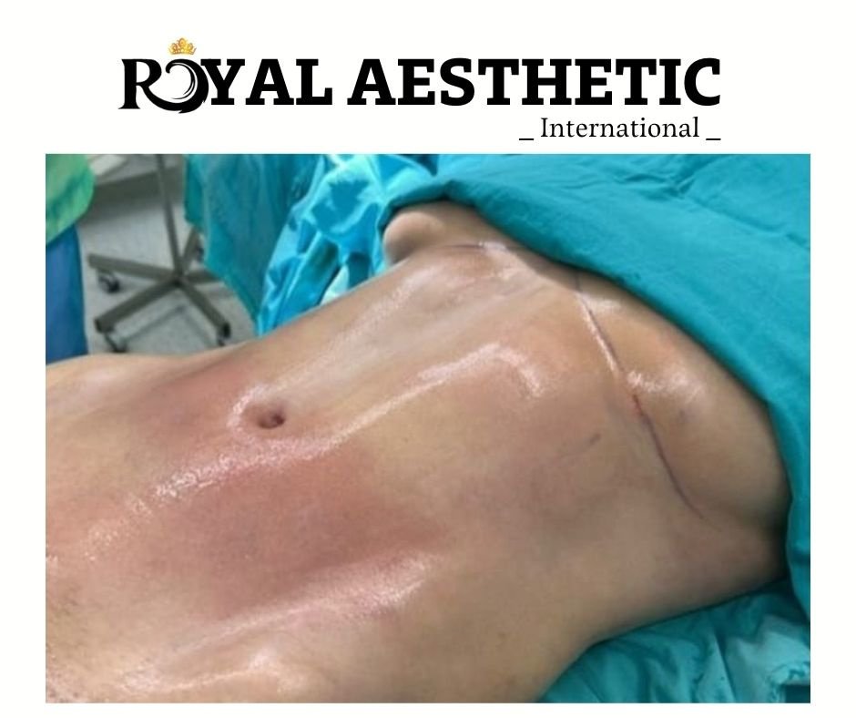 Royal Aesthetic International - Royal Aesthetic International