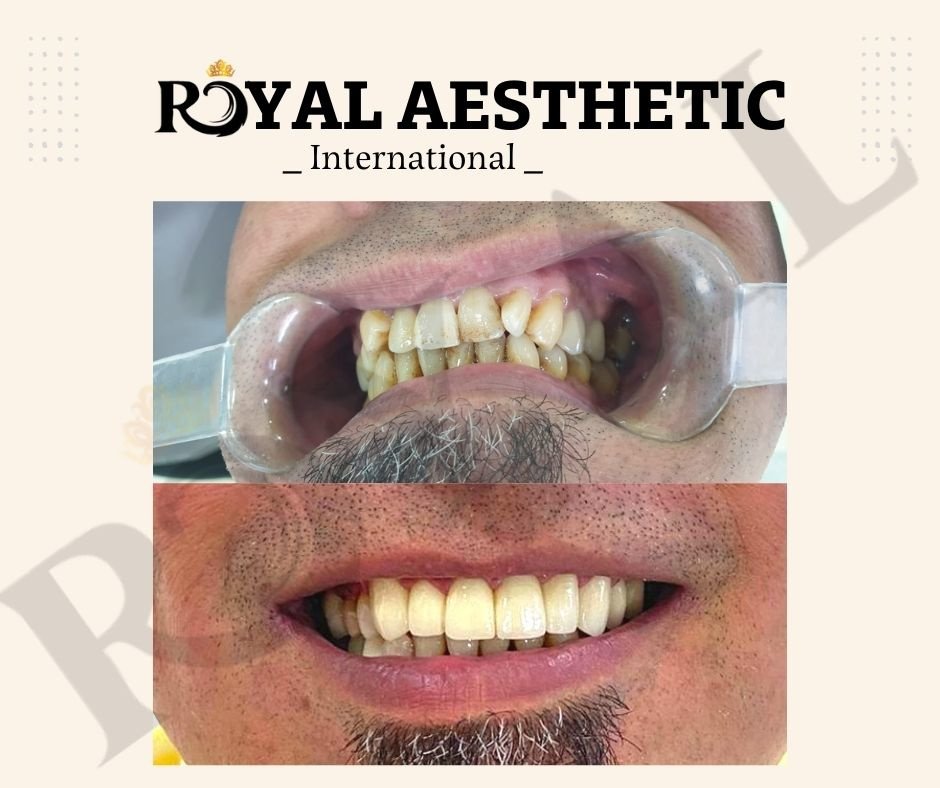 Royal Aesthetic International - Royal Aesthetic International