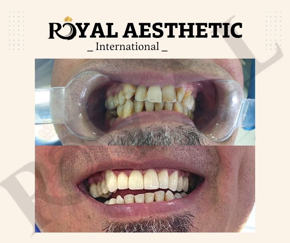 Royal Aesthetic International - Royal Aesthetic International