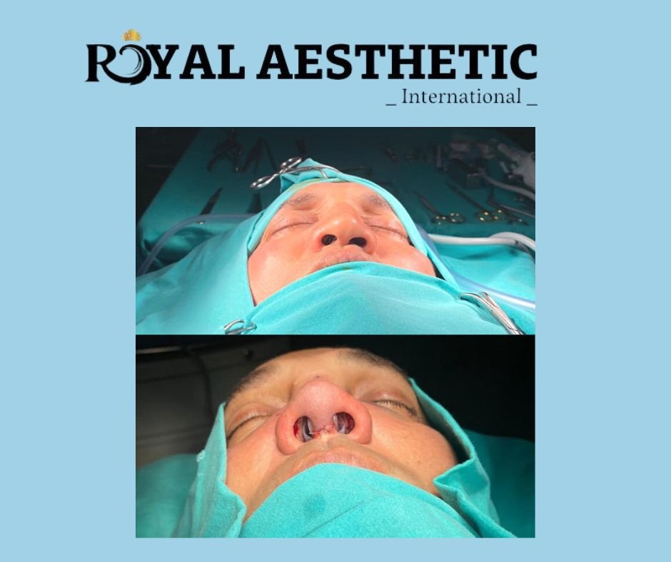 Royal Aesthetic International - Royal Aesthetic International
