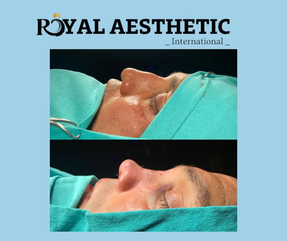 Royal Aesthetic International - Royal Aesthetic International