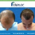 RR كابيلار - RR Capilar
