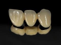 RS Dental and Implant Centre - RS Dental and Implant Centre