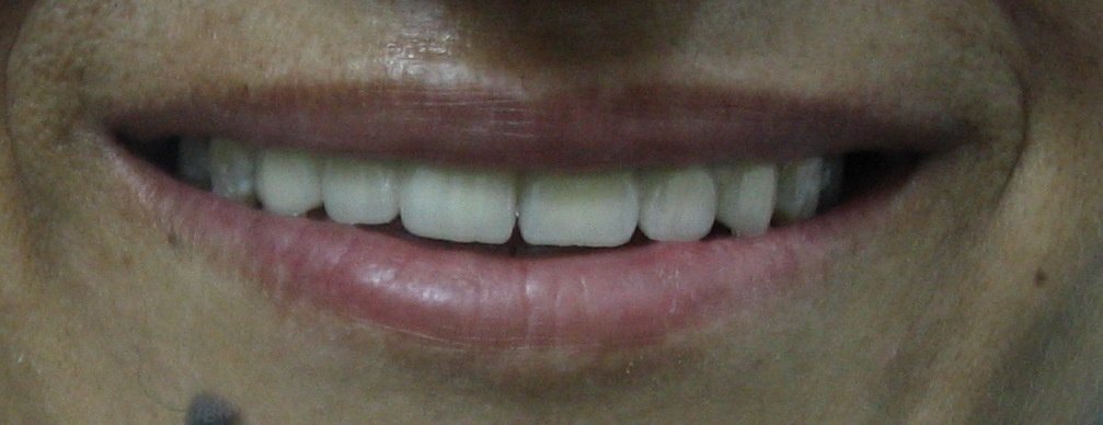 R.S.COSMETIC AND DENTAL IMLANT CENTRE - R.S.COSMETIC AND DENTAL IMLANT CENTRE