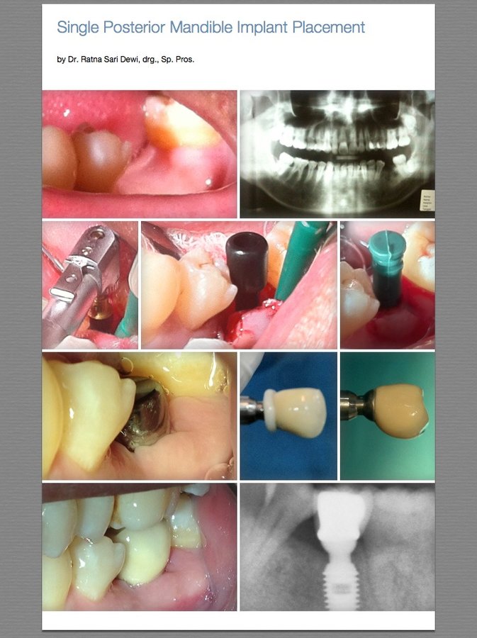 RSD Dental Esthetic & Implant Center - RSD Dental Esthetic & Implant Center