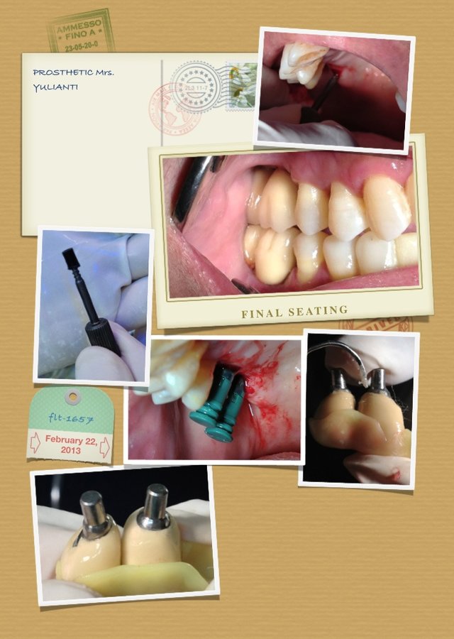 RSD Dental Esthetic & Implant Center - RSD Dental Esthetic & Implant Center