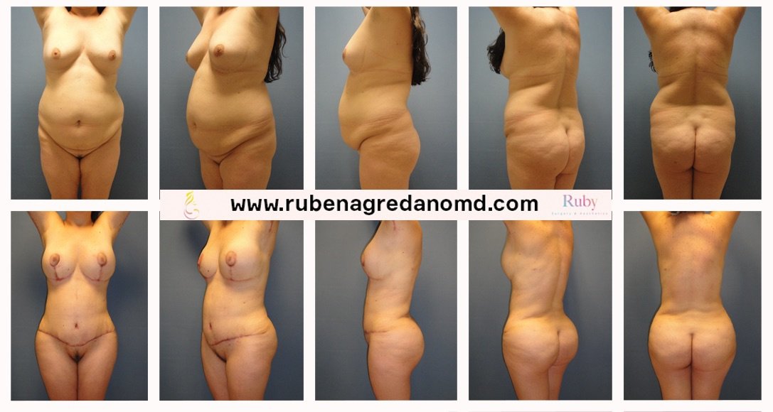 Ruby, Surgery & Aesthetics - Ruby, Surgery & Aesthetics