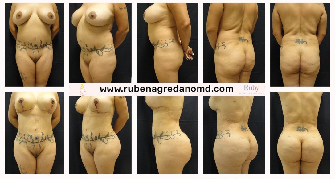 Ruby, Surgery & Aesthetics - Ruby, Surgery & Aesthetics