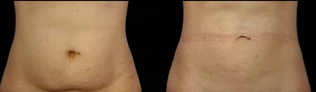 روث جاكسون جماليات - Ruth Jackson Aesthetics