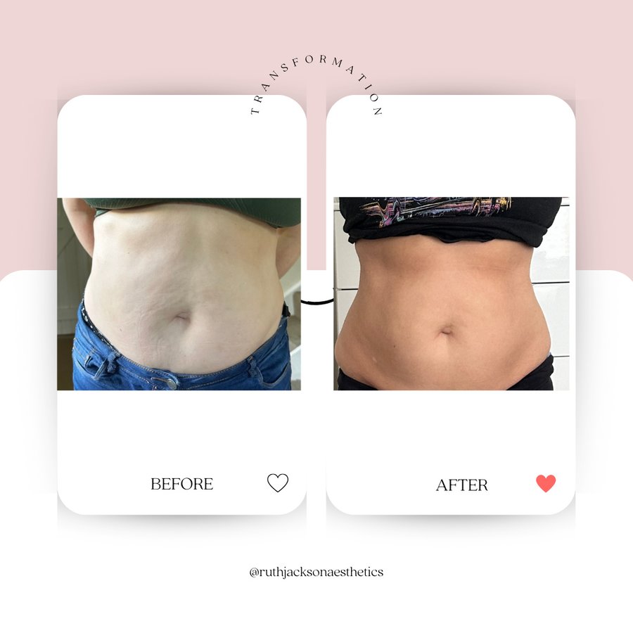 روث جاكسون جماليات - Ruth Jackson Aesthetics
