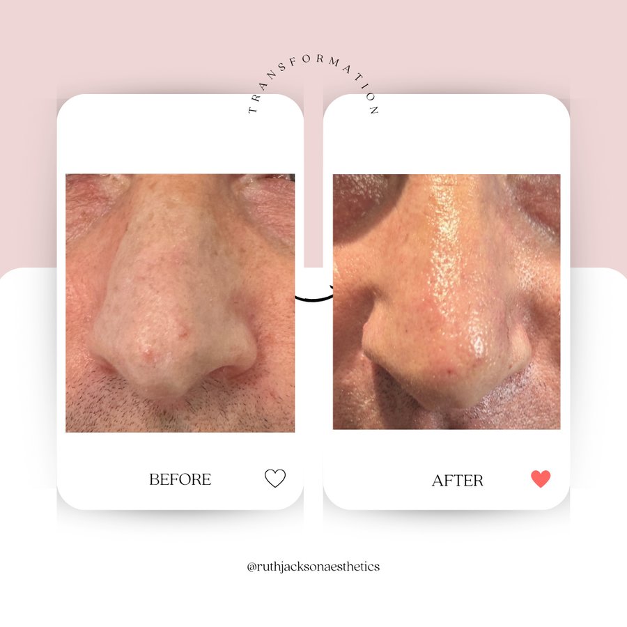 روث جاكسون جماليات - Ruth Jackson Aesthetics