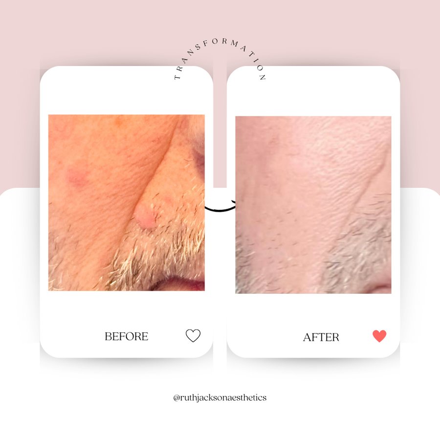 روث جاكسون جماليات - Ruth Jackson Aesthetics