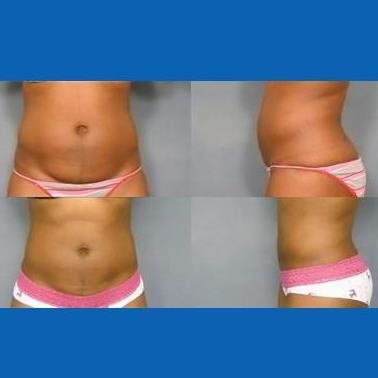 روثي ماكراري ، دكتوراه في الطب - مركز ديترويت الطبي - Ruthie McCrary, M.D - Detroit Medical Center