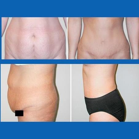 Ruthie McCrary, M.D - Plastic and Cosmetic Surgery - Ruthie McCrary, M.D - Plastic and Cosmetic Surgery