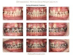 Sachi Multispecality Dental Hospital and Implant Center - Sachi Multispecality Dental Hospital and Implant Center