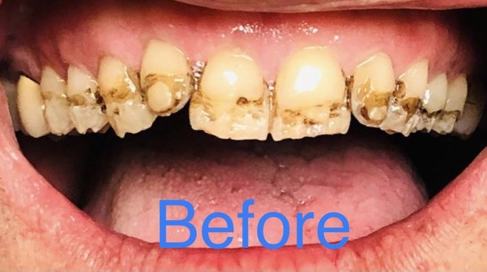 سالفاتوري طبيب أسنان - Salvatori Dentist