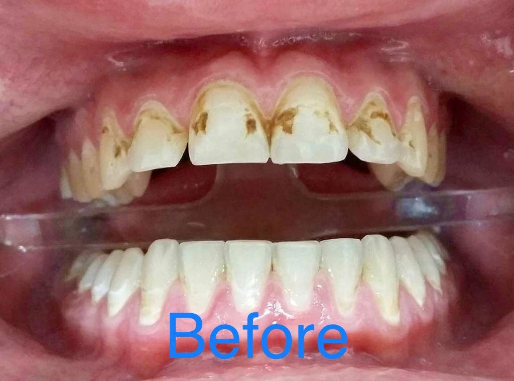 سالفاتوري طبيب أسنان - Salvatori Dentist