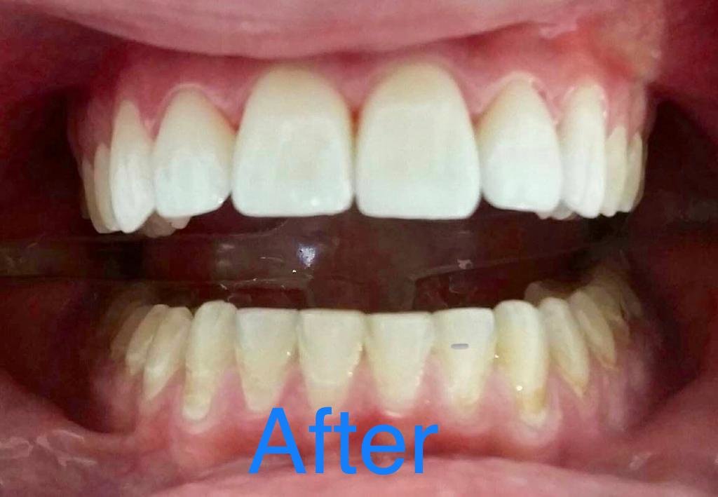 سالفاتوري طبيب أسنان - Salvatori Dentist