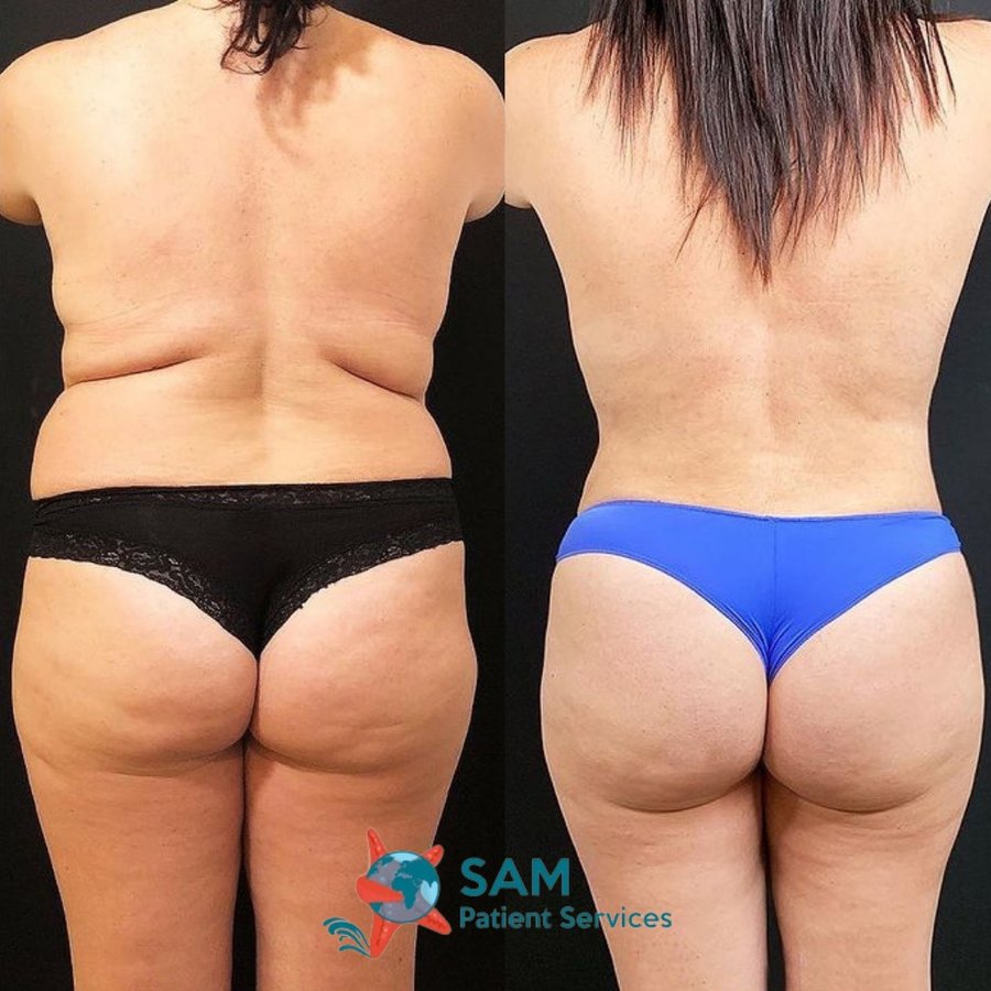 SAM Patient Services - Plastic Surgery - SAM Patient Services - Plastic Surgery