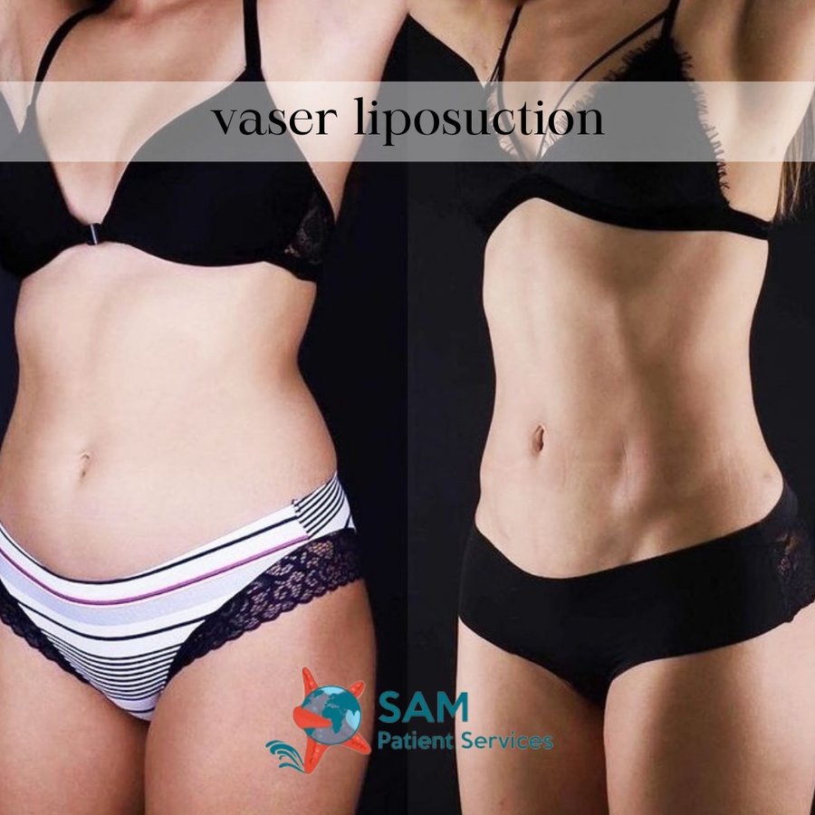 SAM Patient Services - Plastic Surgery - SAM Patient Services - Plastic Surgery