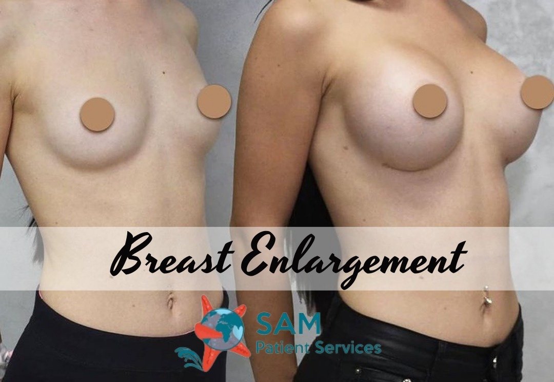 SAM Patient Services - Plastic Surgery - SAM Patient Services - Plastic Surgery