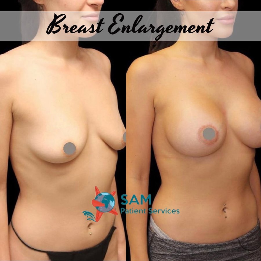 SAM Patient Services - Plastic Surgery - SAM Patient Services - Plastic Surgery