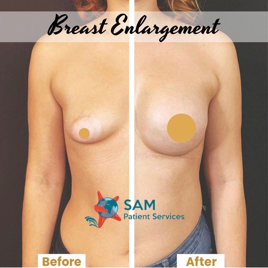 SAM Patient Services - Plastic Surgery - SAM Patient Services - Plastic Surgery