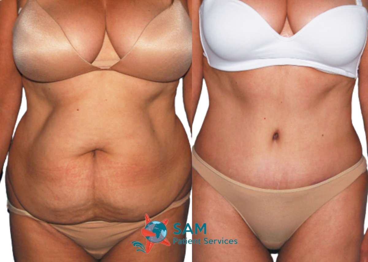 SAM Patient Services - Plastic Surgery - SAM Patient Services - Plastic Surgery