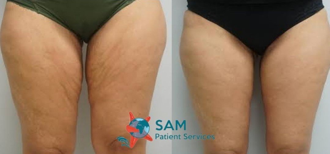 SAM Patient Services - Plastic Surgery - SAM Patient Services - Plastic Surgery