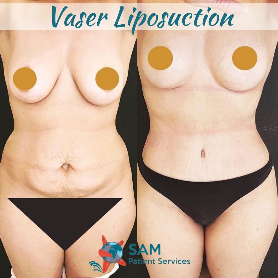 SAM Patient Services - Plastic Surgery - SAM Patient Services - Plastic Surgery