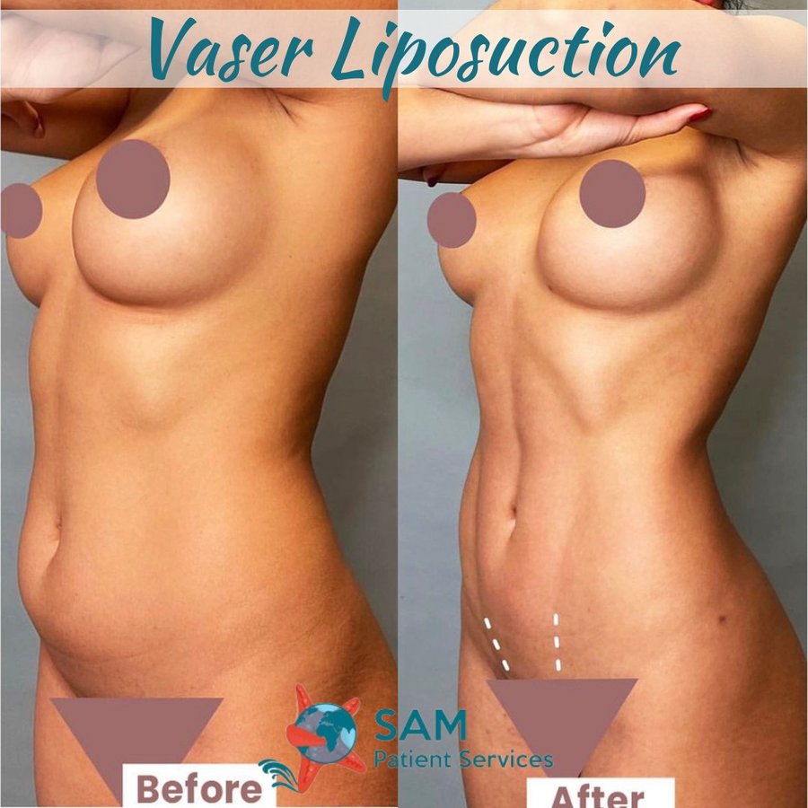 SAM Patient Services - Plastic Surgery - SAM Patient Services - Plastic Surgery