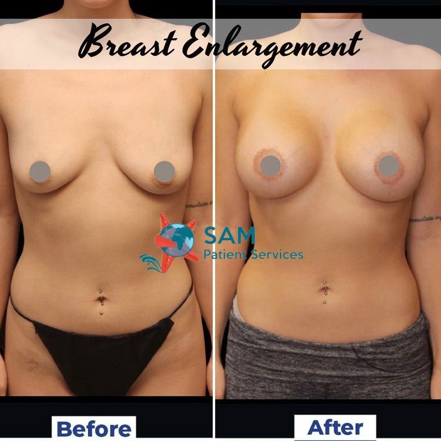 SAM Patient Services - Plastic Surgery - SAM Patient Services - Plastic Surgery