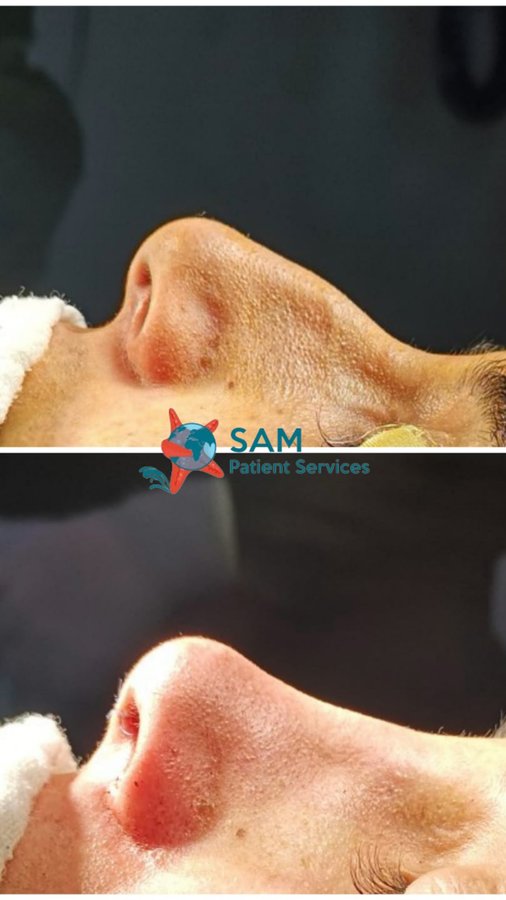 SAM Patient Services - Plastic Surgery - SAM Patient Services - Plastic Surgery