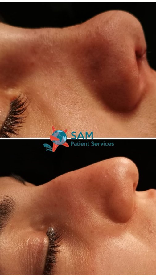 SAM Patient Services - Plastic Surgery - SAM Patient Services - Plastic Surgery