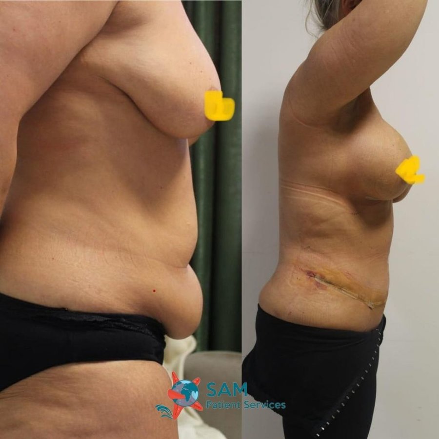 SAM Patient Services - Plastic Surgery - SAM Patient Services - Plastic Surgery