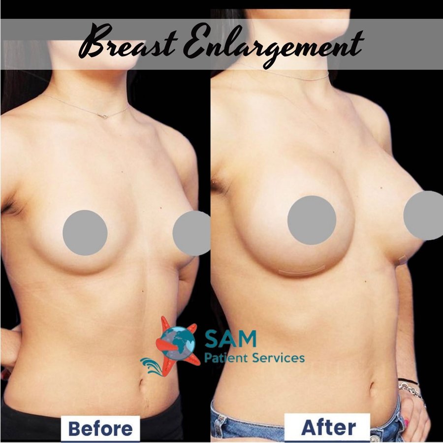 SAM Patient Services - Plastic Surgery - SAM Patient Services - Plastic Surgery